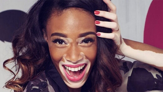 Winnie harlow white