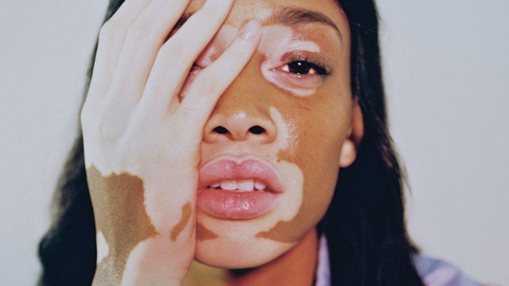 Winnie harlow body