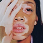 Winnie harlow body