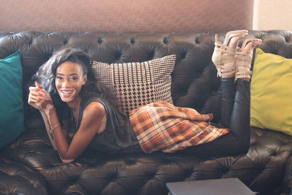 Winnie harlow legs