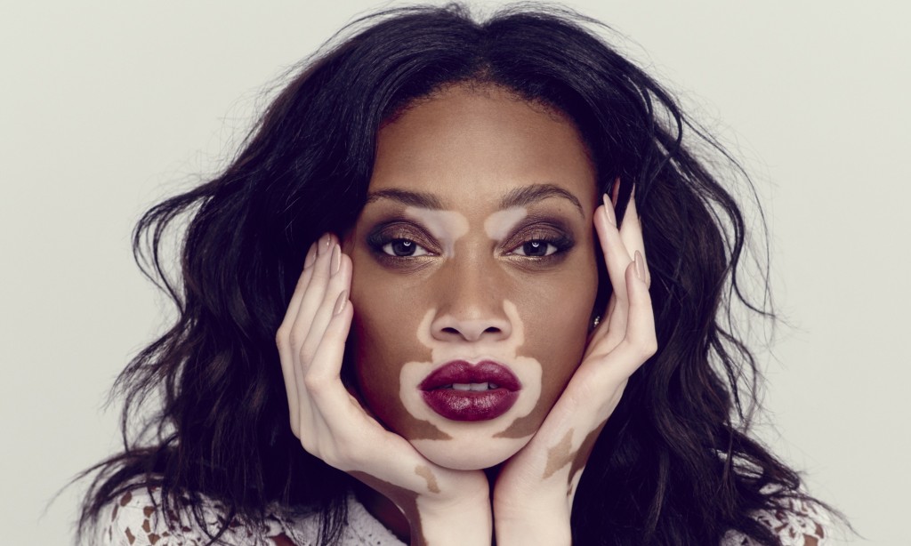 Winnie harlow race