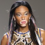 Winnie harlow vitiligo