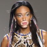 Winnie harlow vitiligo